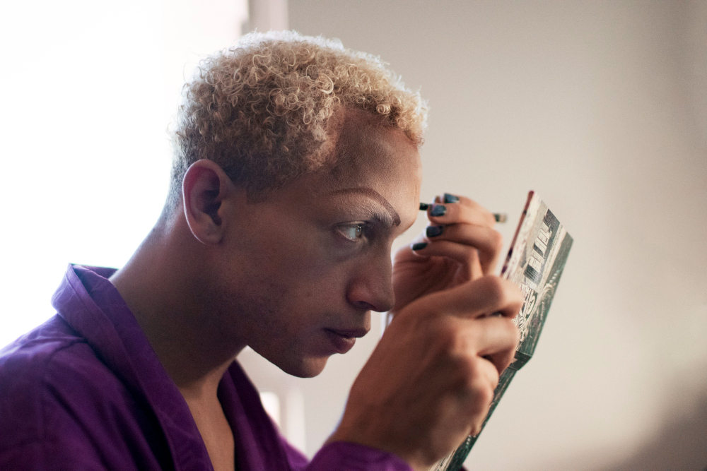 Benefits of Brow Bone Reduction Surgery